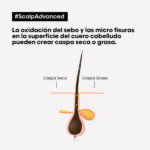 SHAMPOO CAPILAR L’OREAL SERIE EXPERT SCALP ADVANCED ANTI-PELLICULAIRE DANDRUFF 300ML - Imagen 4