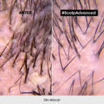 SHAMPOO CAPILAR L’OREAL SERIE EXPERT SCALP ADVANCED ANTI-PELLICULAIRE DANDRUFF 300ML - Imagen 5