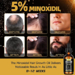 SÉRUM CAPILAR SEFRALLS HAIR GENERATION 5% MINOXIDIL 60ML - Imagen 6