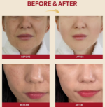 ESENCIA FACIAL K-SECRET SEOUL 1988 SNAIL MUCIN 97% + RICE 100ML - Imagen 5
