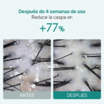 AMPOLLA CAPILAR LILYEVE SCALP TURN CICA PDRN BRUSH 100ML - Imagen 9