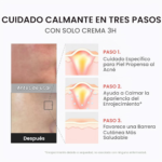 CREMA FACIAL MEDICUBE HYPOCHLOROUS 3H RELIEF 50ML - Imagen 5